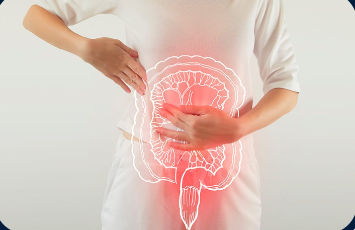 Tumeur colorectale
